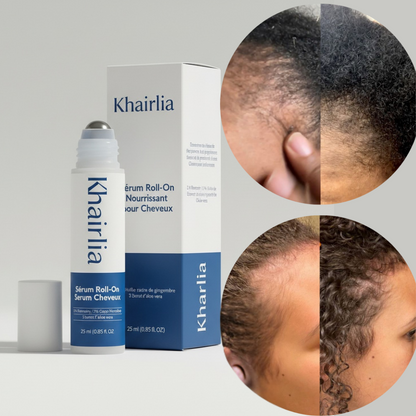 Khairlia | Roll-on Anti Tempes Dégarnies